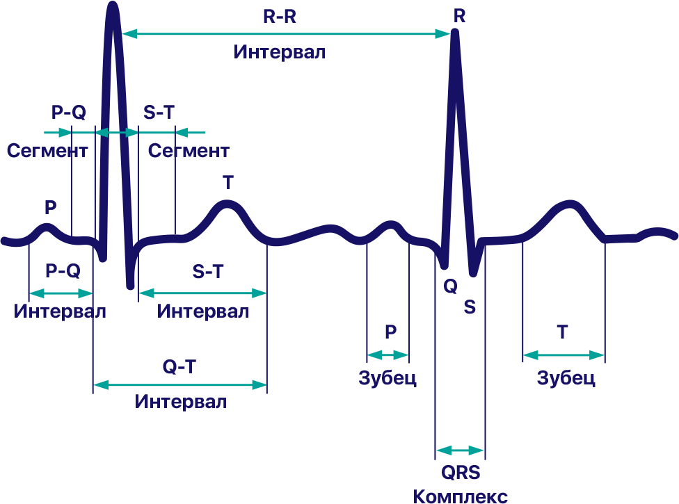 EKG EKG
