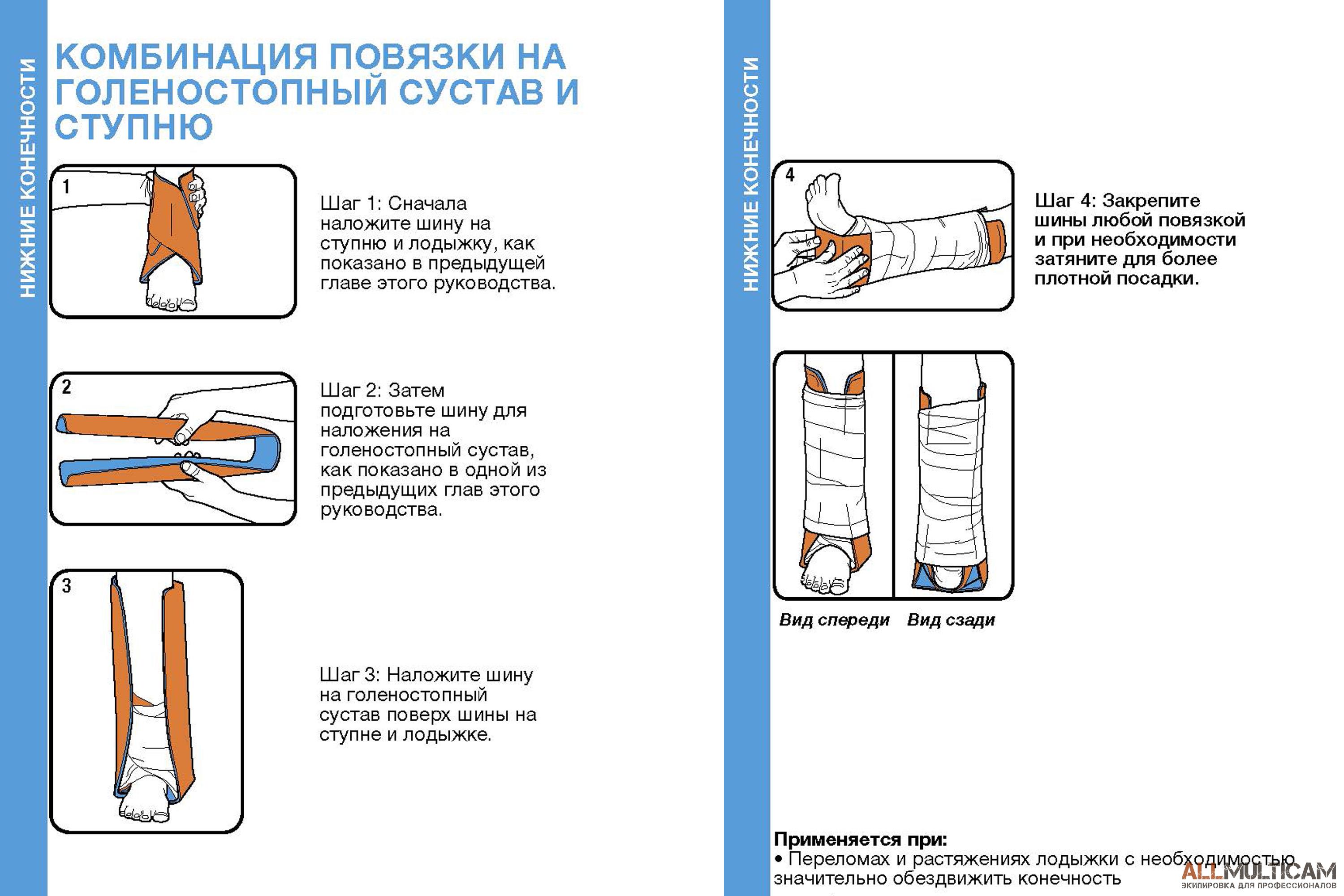 Комбинация повязки на голеностопный сустав и ступню