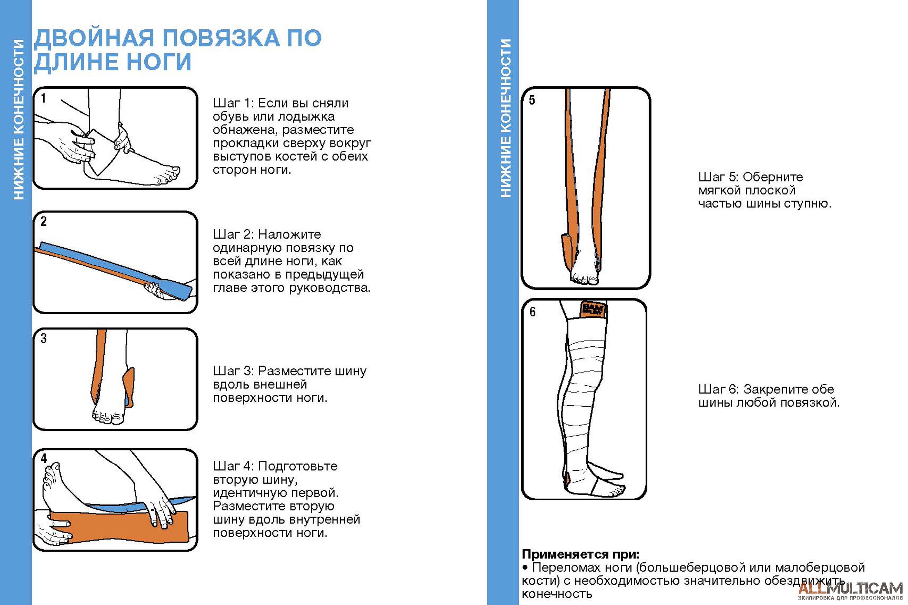 Двойная повязка по длине ноги