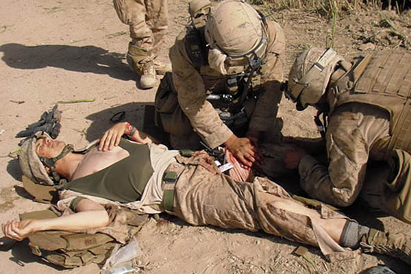 Замена турникета израильским бандажом ALLMULTICAM