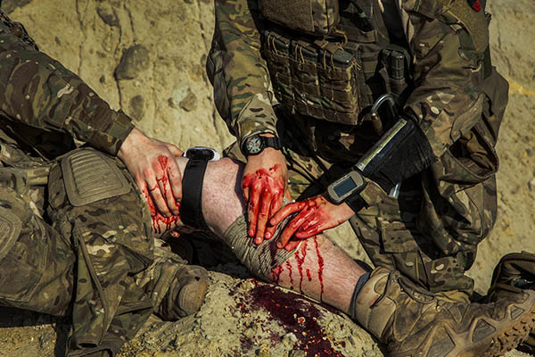 Замена турникета израильским бандажом ALLMULTICAM