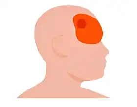 Боль в глазах Боль в глазах