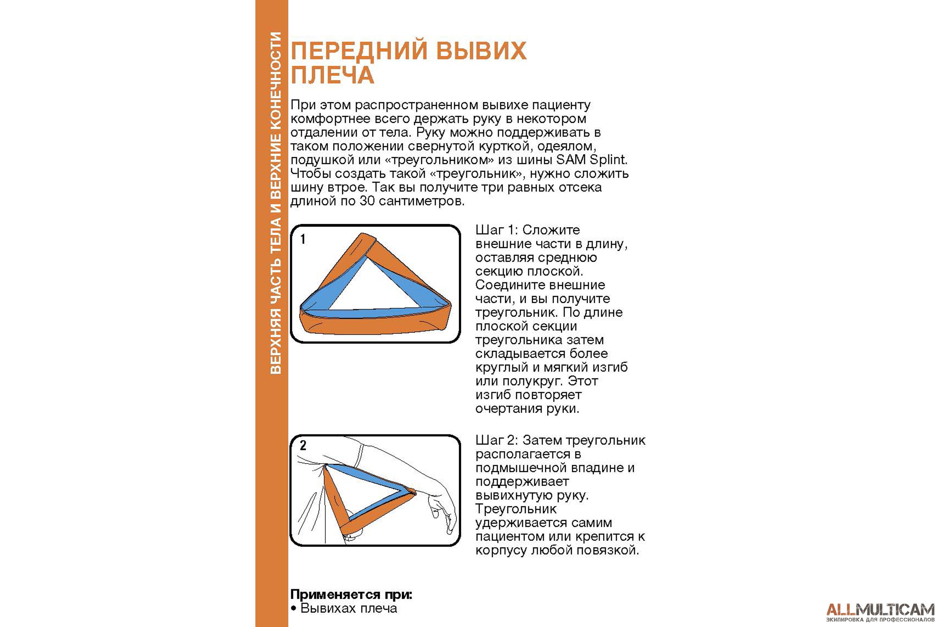 Вывих плеча