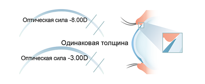 Lens-2_14x.png