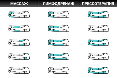 Надув камер манжеты на руку Надув камер в режимах массаж, лимфодренаж и прессотерапия