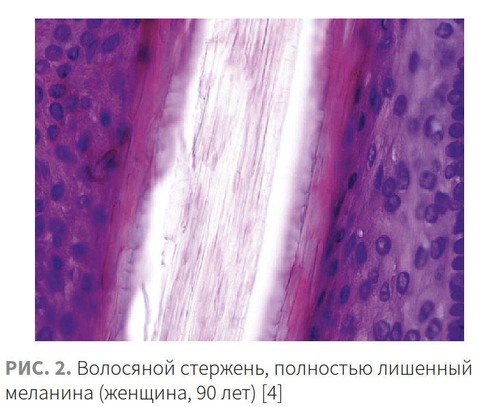 Ибатуллина (КМ 2-2023 (Ипсен) Рис 2 Ибатуллина (КМ 2-2023 (Ипсен) Рис 2.png