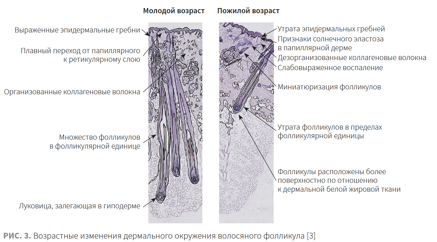 Ибатуллина (КМ 2-2023 (Ипсен) Рис 3 Ибатуллина (КМ 2-2023 (Ипсен) Рис 3.png
