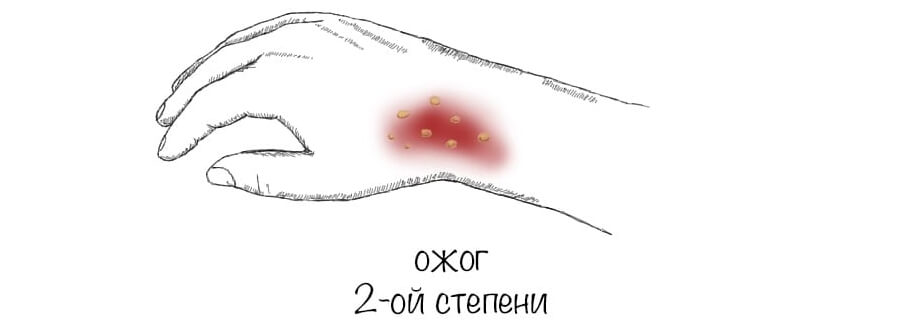 описание фото