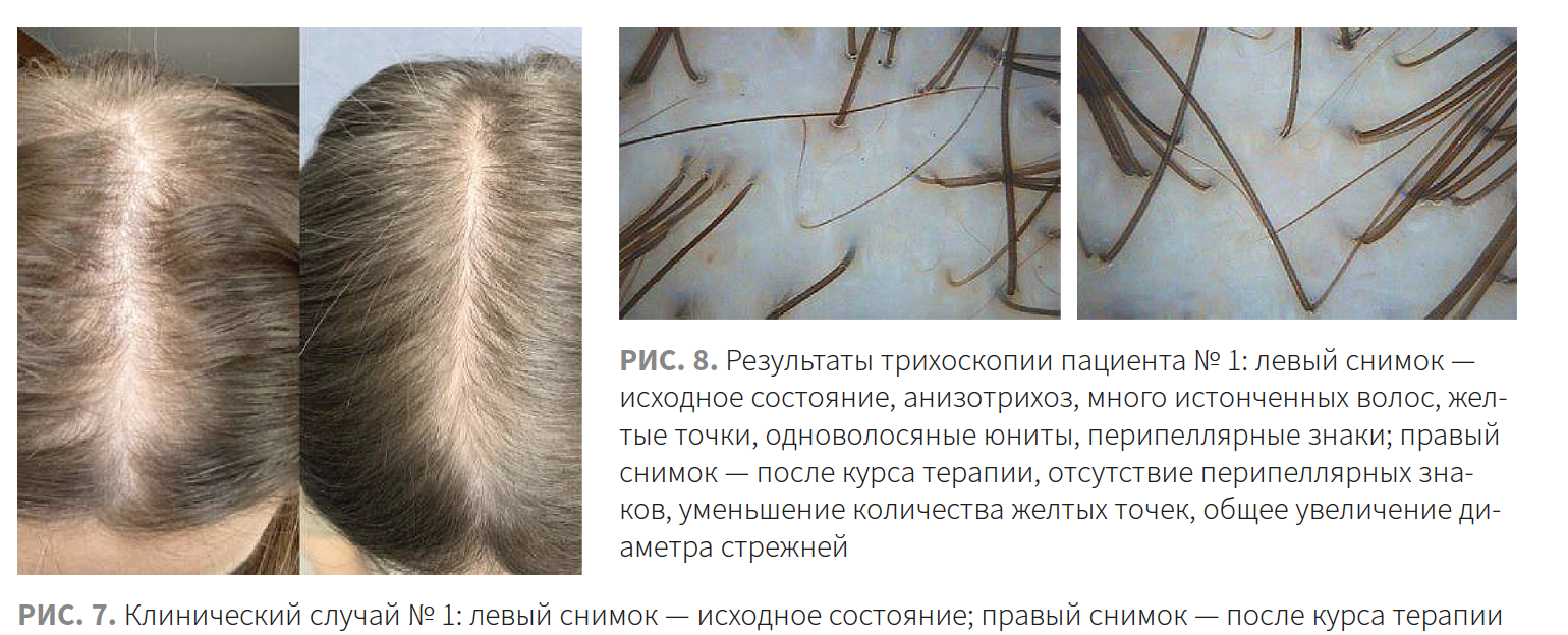 Ибатуллина (КМ 2-2023 (Ипсен) Рис 7-8 Ибатуллина (КМ 2-2023 (Ипсен) Рис 7-8.png