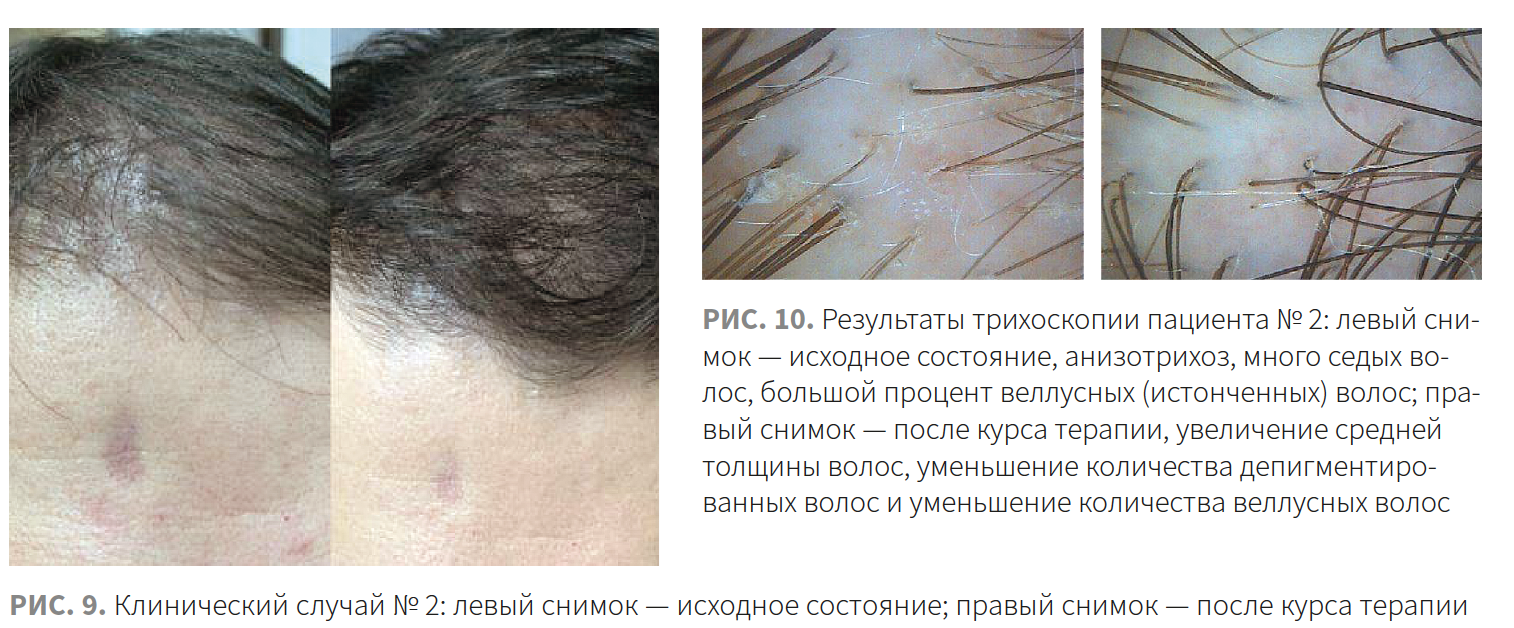 Ибатуллина (КМ 2-2023 (Ипсен) Рис 9-10 Ибатуллина (КМ 2-2023 (Ипсен) Рис 9-10.png