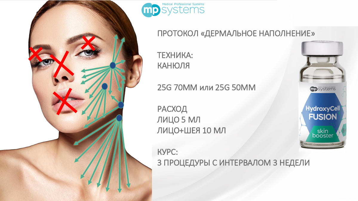 HydroxyCell Fusion MP Systems_Протокол_1 HydroxyCell Fusion MP Systems_Протокол_1.jpg