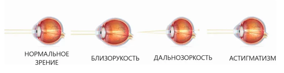 Заболевания Заболевания
