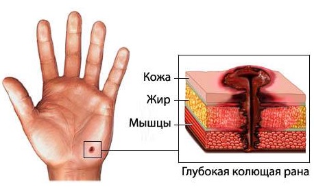 описание фото