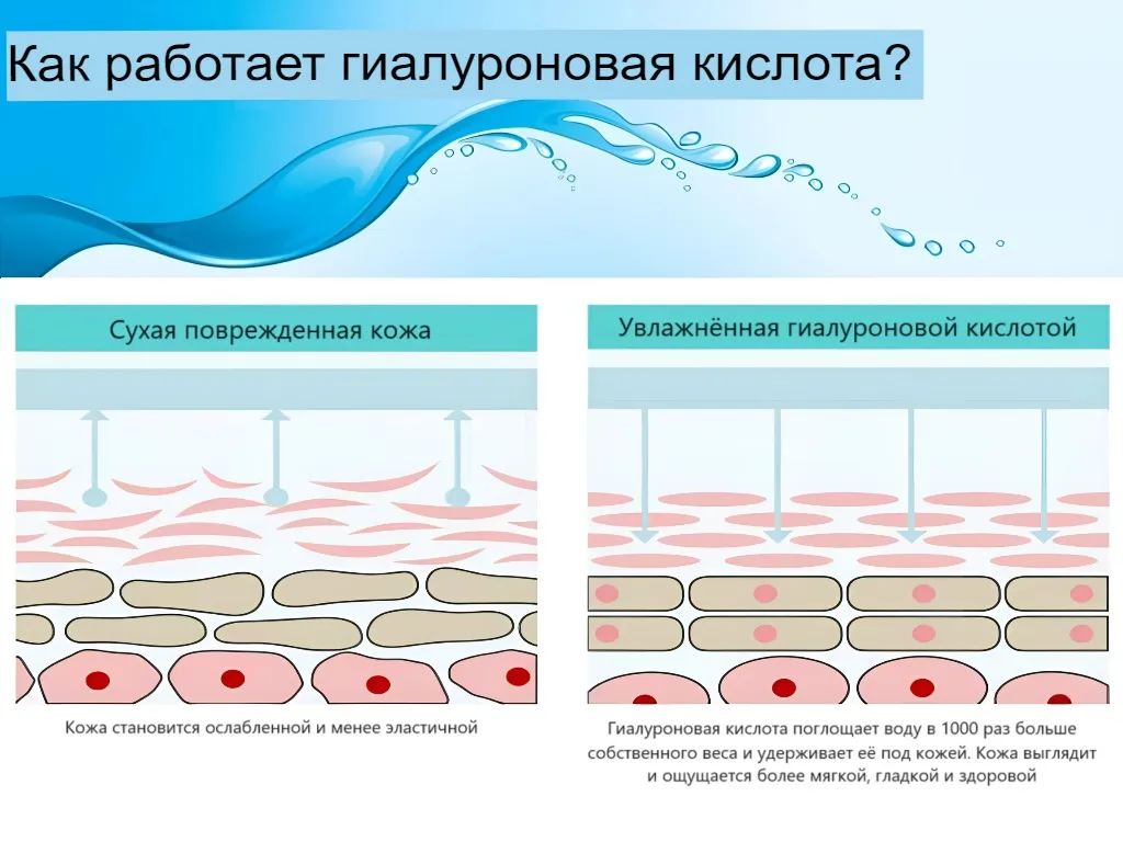 Как работает гиалуроновая кислота Как работает гиалуроновая кислота