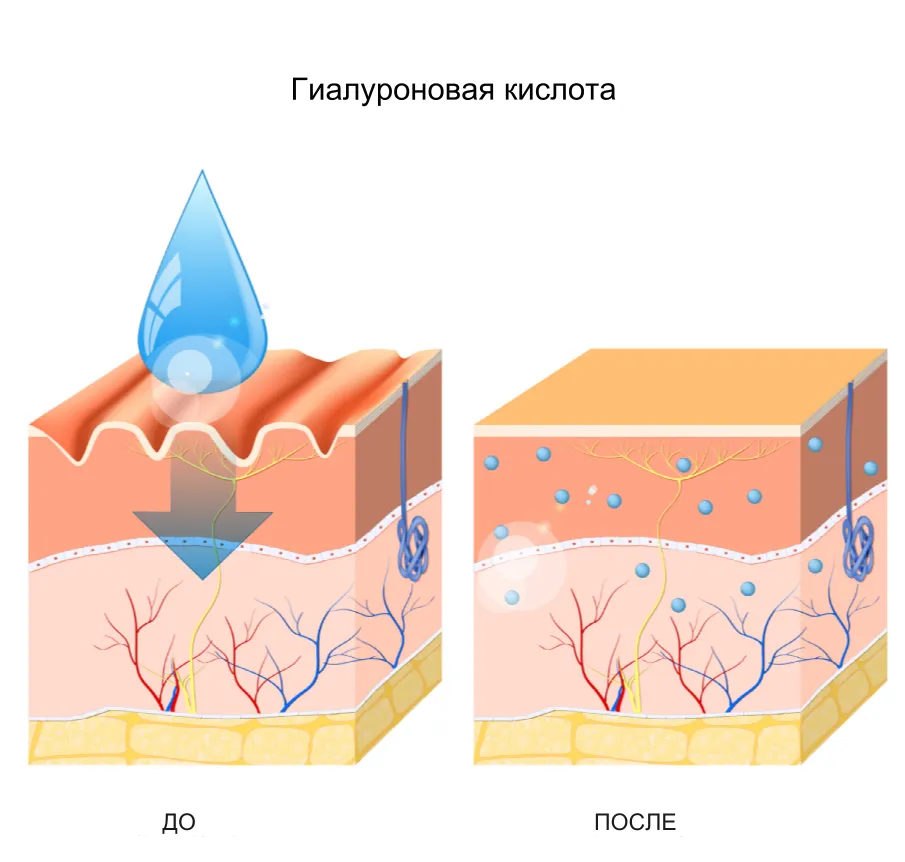 Что такое гиалуроновая кислота Что такое гиалуроновая кислота