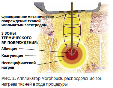 Лысикова (КИТ МЕД) КМ 1-2024_Рис 2 Лысикова (КИТ МЕД) КМ 1-2024_Рис 2.png