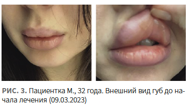 Лысикова (КИТ МЕД) КМ 1-2024_Рис 3 Лысикова (КИТ МЕД) КМ 1-2024_Рис 3.png