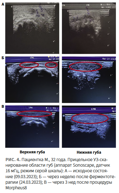 Лысикова (КИТ МЕД) КМ 1-2024_Рис 4 Лысикова (КИТ МЕД) КМ 1-2024_Рис 4.png