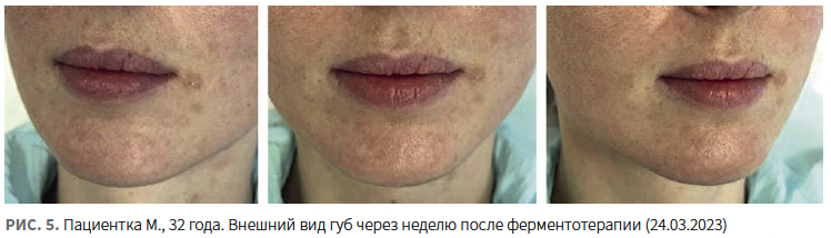 Лысикова (КИТ МЕД) КМ 1-2024_Рис 5.png