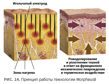 Лысикова (КИТ МЕД) КМ 1-2024_Рис 14 Лысикова (КИТ МЕД) КМ 1-2024_Рис 14.png