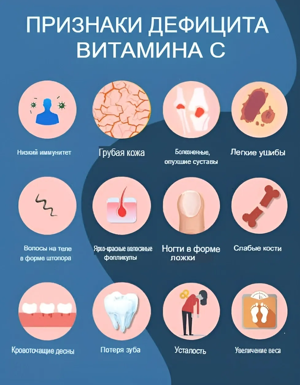 Дефицит витамина C Дефицит витамина C