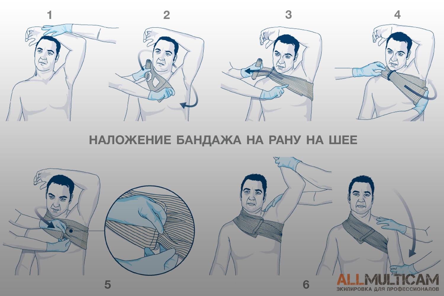 наложение повязки First Care на рану на шее