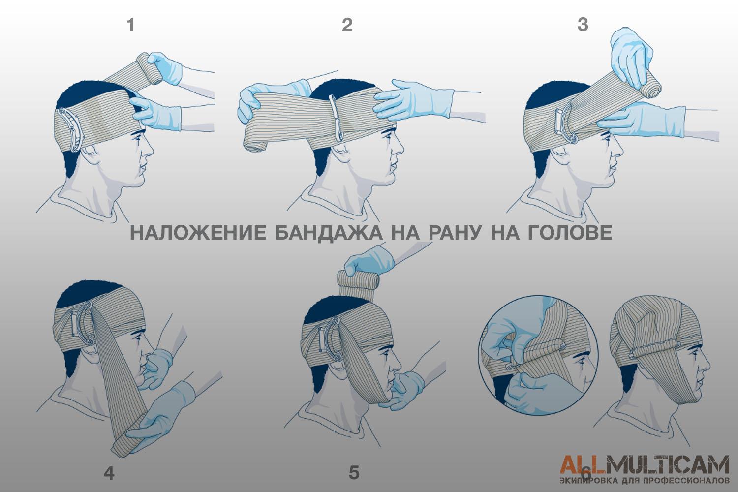 наложение повязки First Care на рану на голове