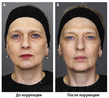 Бычкова (КИТ МЕД) 1-2025_Рис 1 Бычкова (КИТ МЕД) 1-2025_Рис 1.png