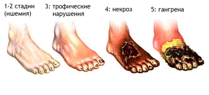 описание фото