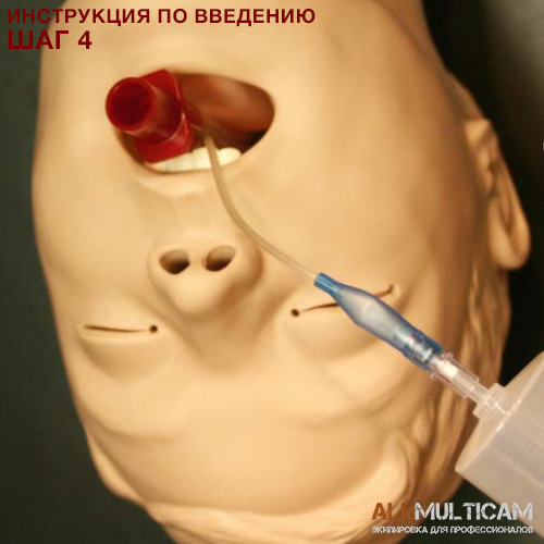 Устройство для дыхательных путей KING LT-D Инструкция шаг 4