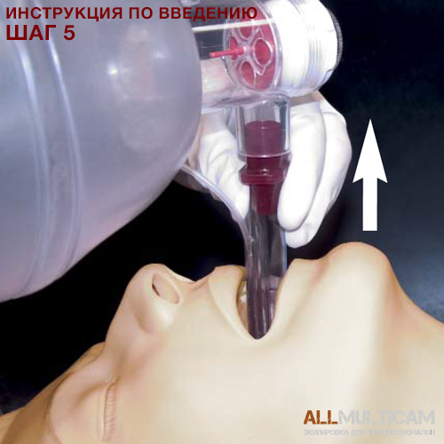 Устройство для дыхательных путей KING LT-D Инструкция шаг 5