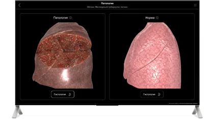 features-pathology_2.png features-pathology_2.png.webp