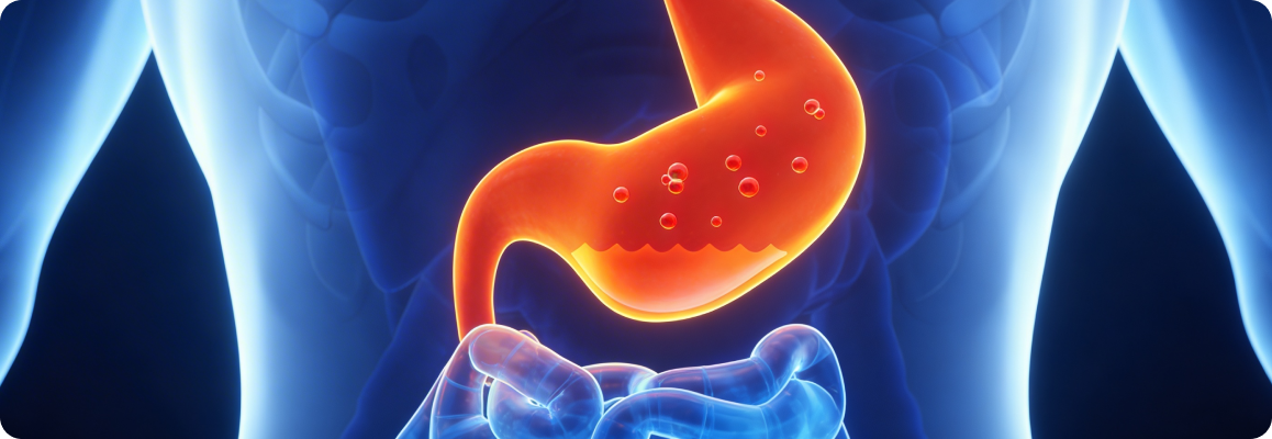 article-hronicheskiygastrit-2.png