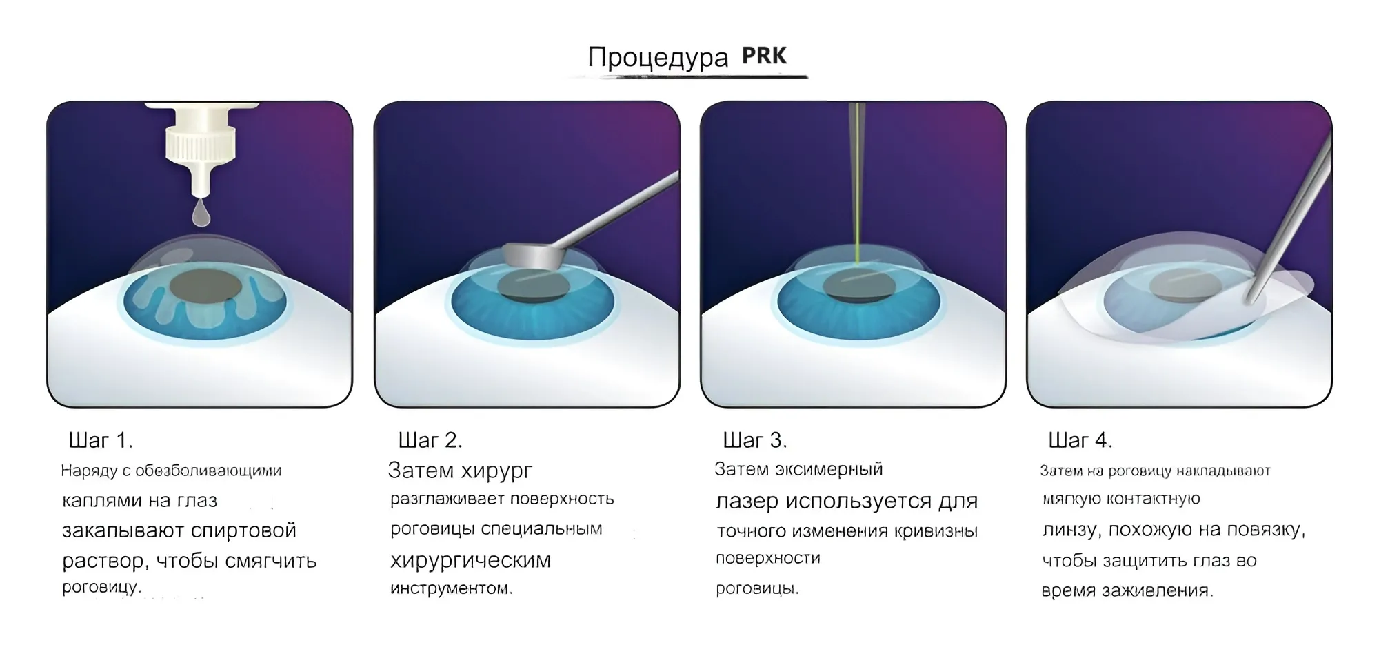 PRK