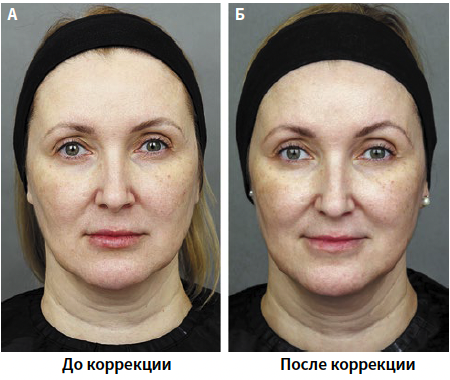 Бычкова (КИТ МЕД) 1-2025_Рис 9 Бычкова (КИТ МЕД) 1-2025_Рис 9.png
