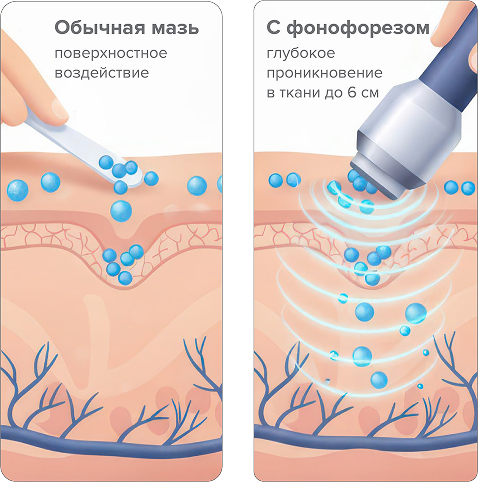 Как действует SELFDOCS АВРОРА&nbsp;— тройная сила воздействия