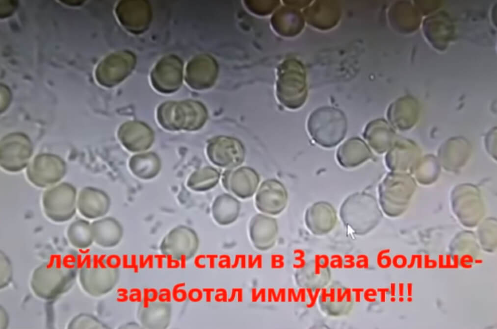 усиление иммунитета и антиоксидантной защиты капли крови после приема ГИДРОПЛАЗМЫ