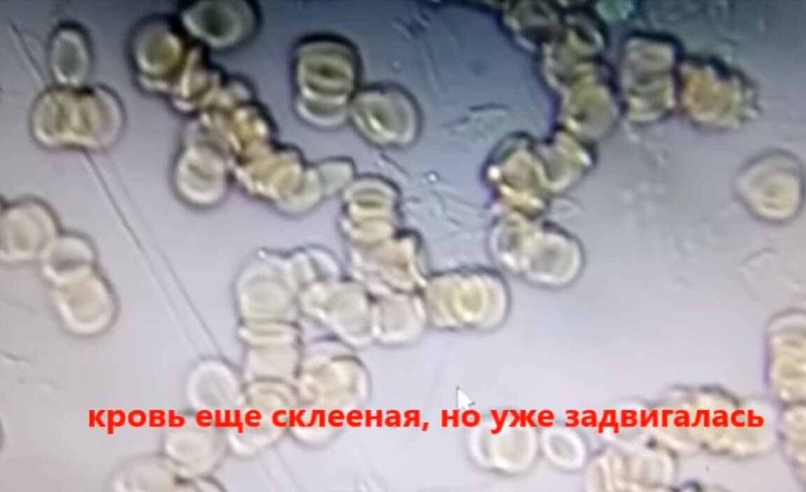 описание капли крови через 5 мин после приема ГИДРОПЛАЗМЫ
