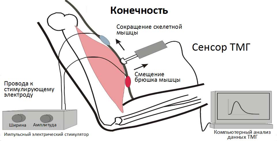 Система диагностики мышц Система диагностики мышц