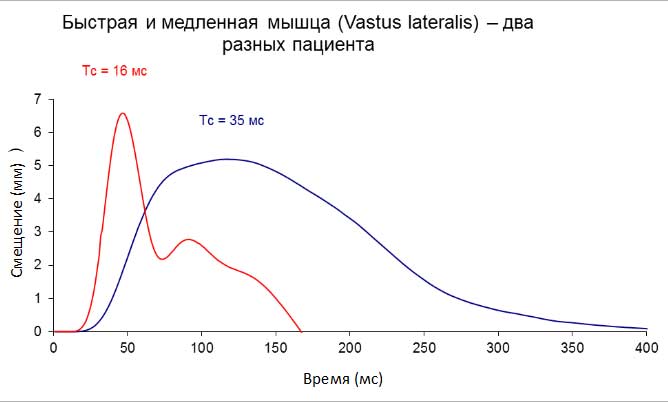 Система диагностики мышц Система диагностики мышц