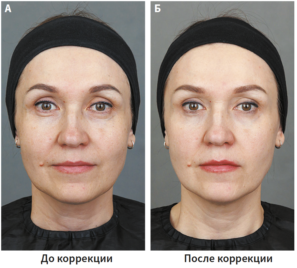 Бычкова (КИТ МЕД) 1-2025_Рис 5 Бычкова (КИТ МЕД) 1-2025_Рис 5.png