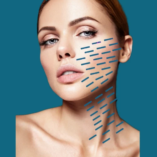 Collagen Stimulate Extra Peptides Gold MP Systems-протокол.webp