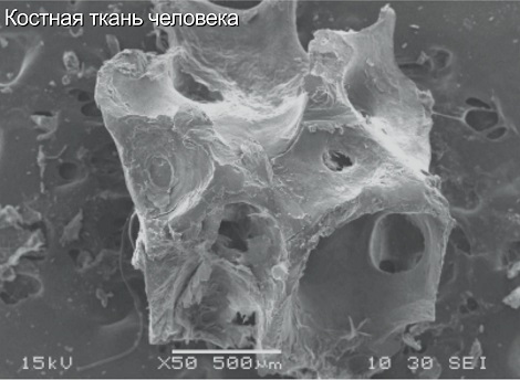 Костная ткань человека.jpg