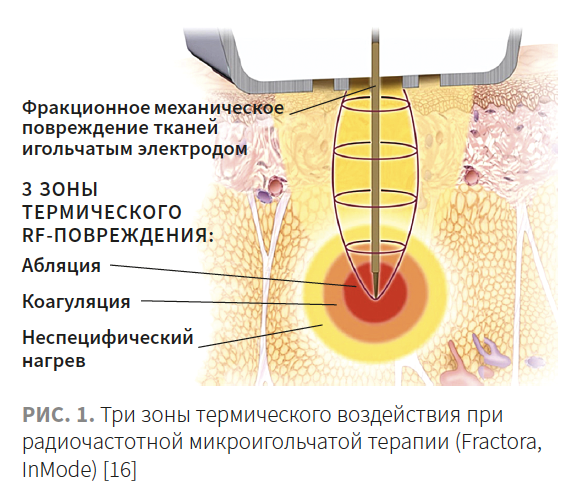 Лысикова КМ 1-2023_Рис 1.png