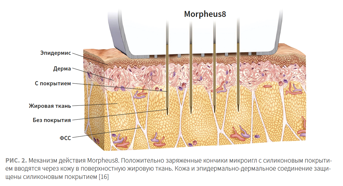 Лысикова КМ 1-2023_Рис 2.png