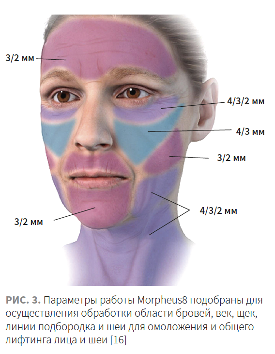 Лысикова КМ 1-2023_Рис 3.png