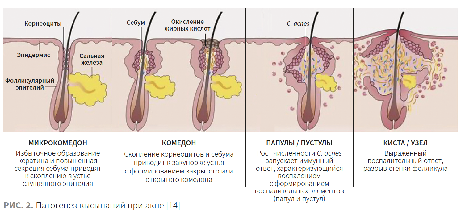 Турубара (Виши) КМ 2-2023_РИС 2.png