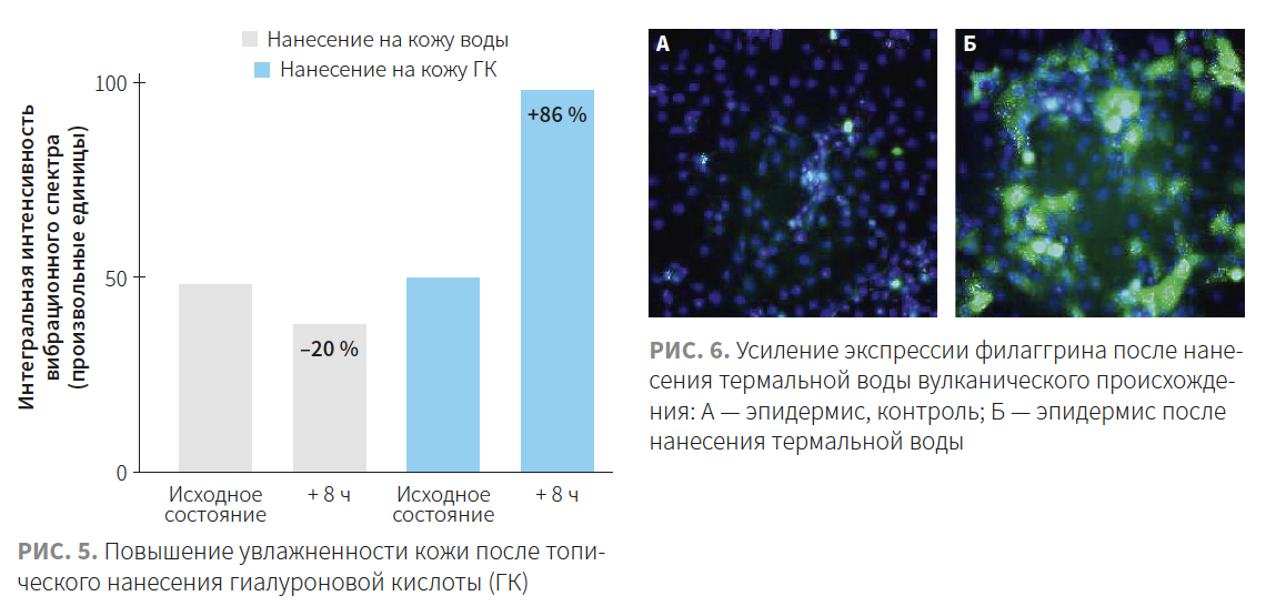 Турубара (Виши) КМ 2-2023_РИС 5-6.png