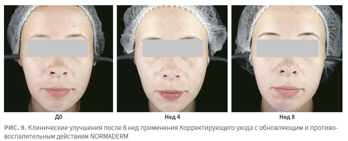 Турубара (Виши) КМ 2-2023_РИС 9.png