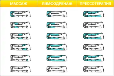 Надув камер манжеты для руки WelbuTech Seven Liner Zam-200 Надув камер в режимах массаж, лимфодренаж и прессотерапия
